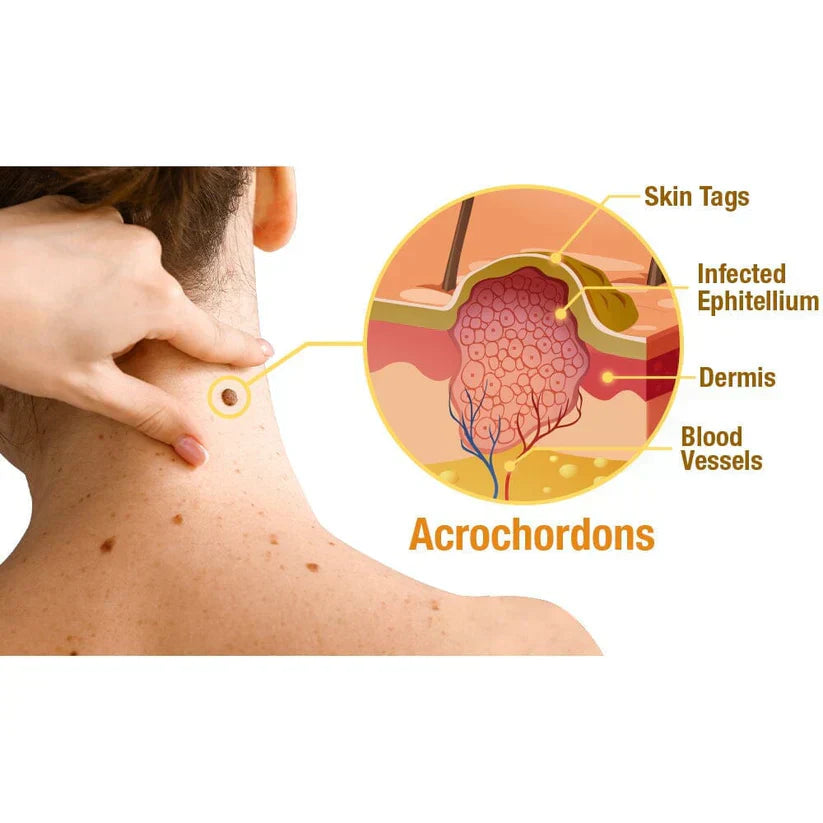 DERMABEE - Manchas en la piel